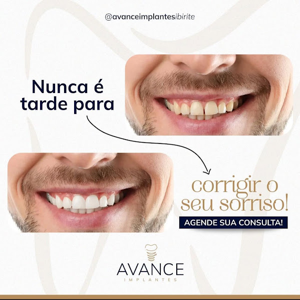 Foto 3 de Avance Implantes Ibirité
