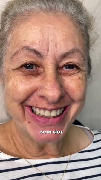 Foto 3 de Avanço Implantes & Estética Dental