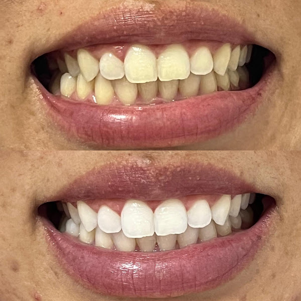 Foto 2 de Avante Odontologia - Unidade Santa Luzia