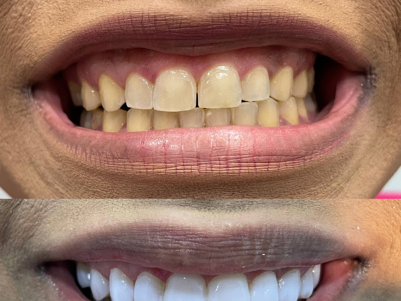 Foto 7 de Avantte Odontologia Especializada | Implante Dentário | Dentista de Emergência | Cordeiro | Recife - PE