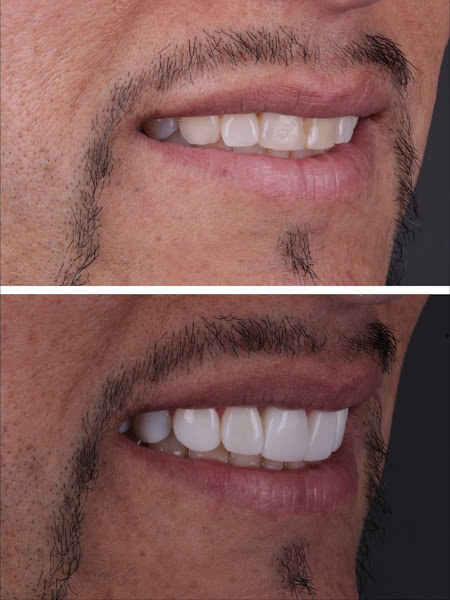 Foto 3 de Ávila Ortodontia - Clínica Odontológica