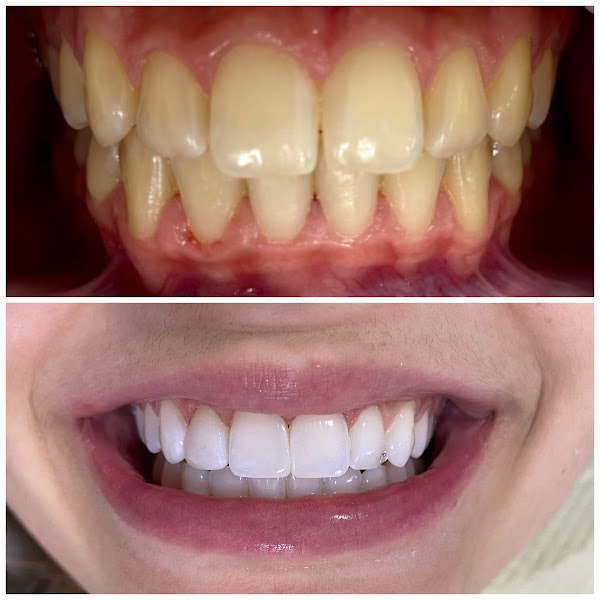 Foto 2 de Avoengo Odontologia