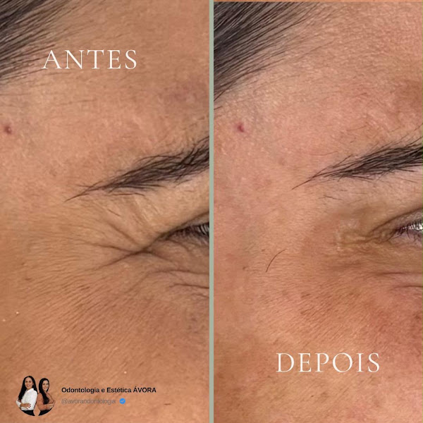 Foto 3 de Ávora Odontologia