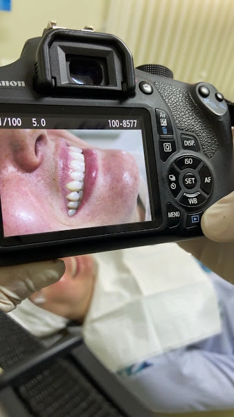 Foto 2 de Avorio Personal Dentist