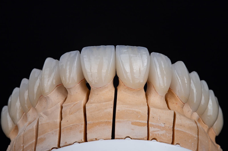 Foto 2 de Axial - Prótese e Estética Dental