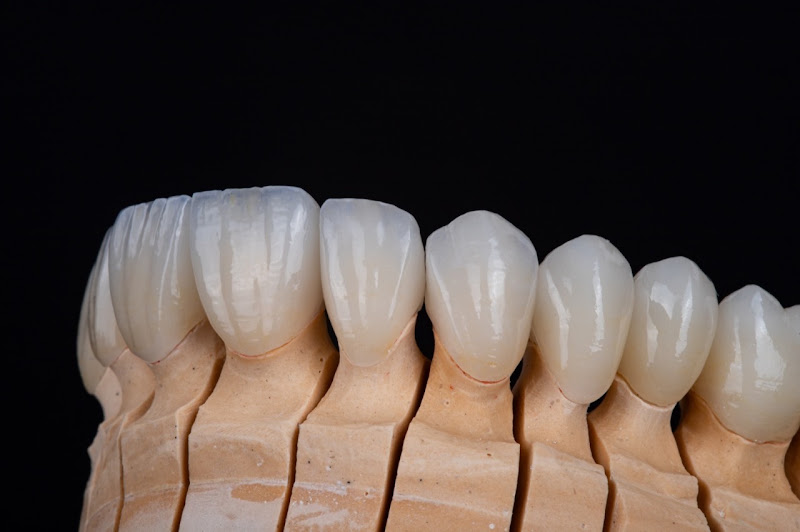Foto 3 de Axial - Prótese e Estética Dental