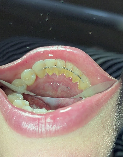 Foto 3 de Ayane Barbalho Odontologia