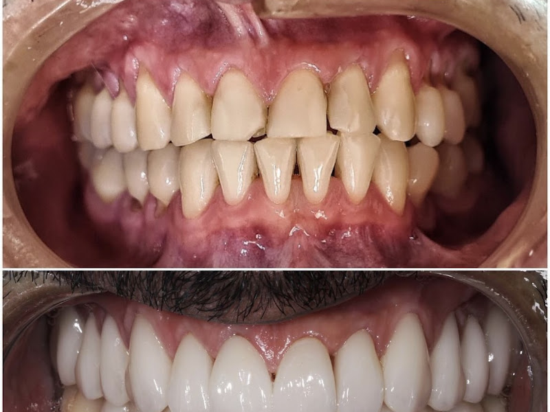 Foto 3 de Aysha Ferro Cirurgiã Dentista