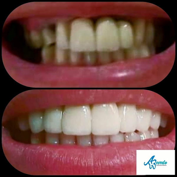 Foto 3 de Azevedo Odontologia