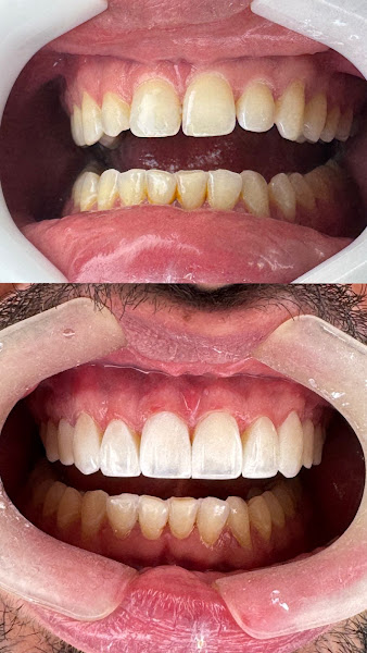 Foto 2 de Azo Odontologia e Estética
