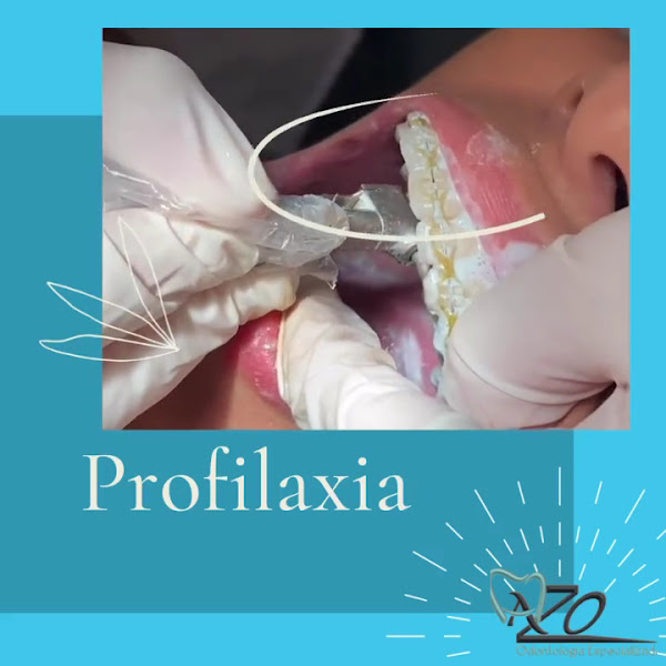 Foto 3 de Azo Odontologia e Estética