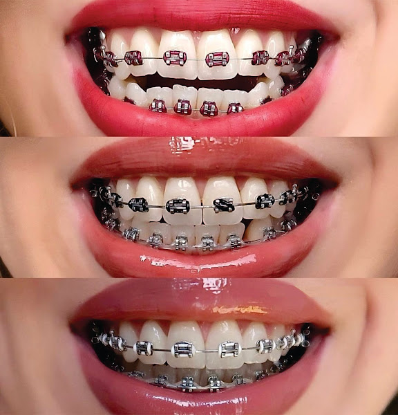 Foto 3 de Azul Odonto Clinica Odontológica