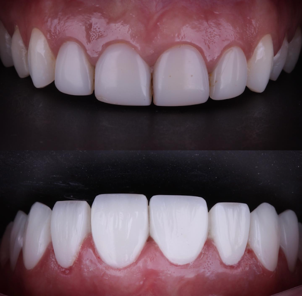 Foto 3 de Bachur Odontologia Especializada