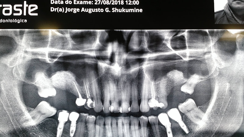 Foto 2 de Ballod e Shukumine Odontologia Especializada