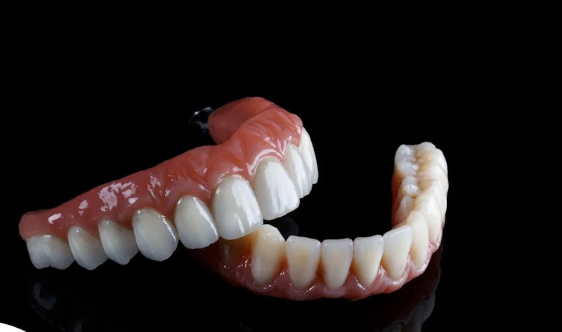 Foto 2 de BAM Odontologia -Implantes