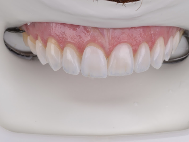 Foto 3 de Barbara Frozza - Odontologia & Harmonização Facial