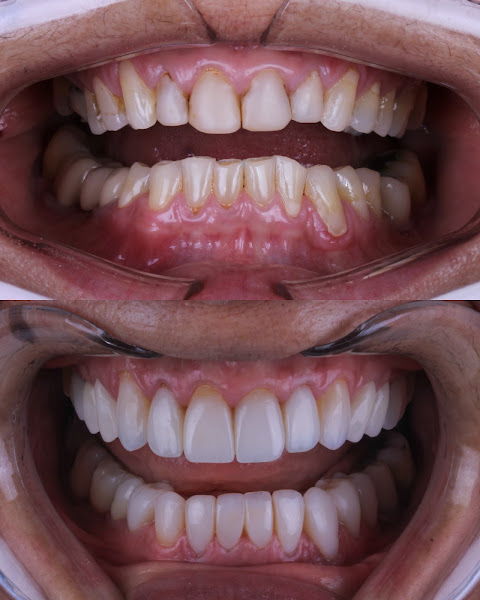 Foto 3 de Bárbara Mello - Odontologia Estética