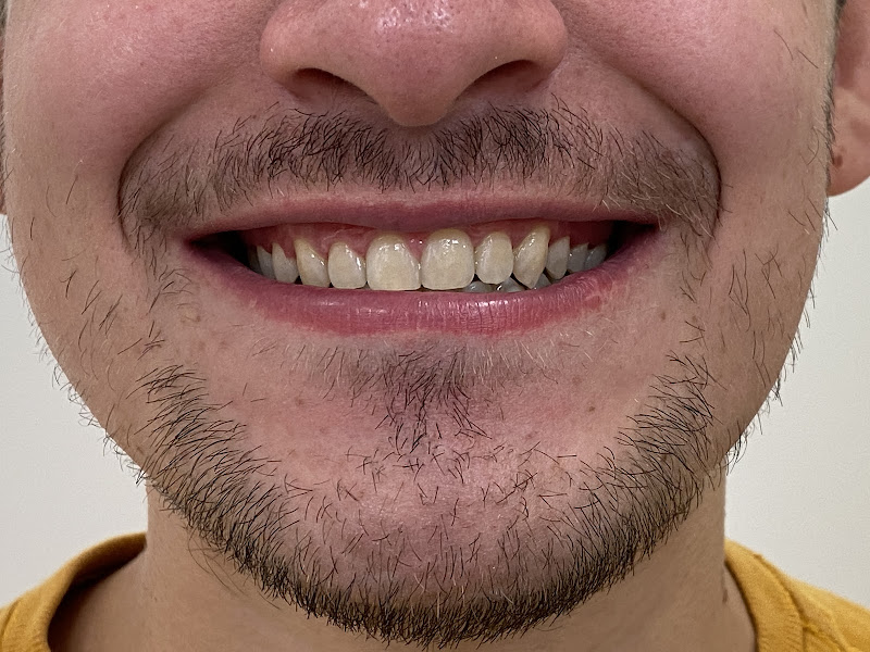 Foto 3 de Baresi Odontologia