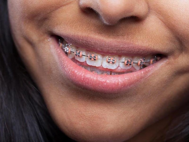 Foto 5 de Barigui Odontologia