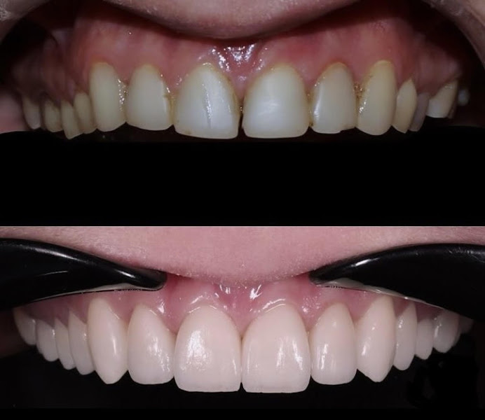 Foto 3 de Barra Space Dental / Reabilitação Oral & Harmonização Orofacial