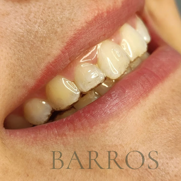 Foto 3 de BARROS ODONTOLOGIA ESPECIALIZADA COTIA