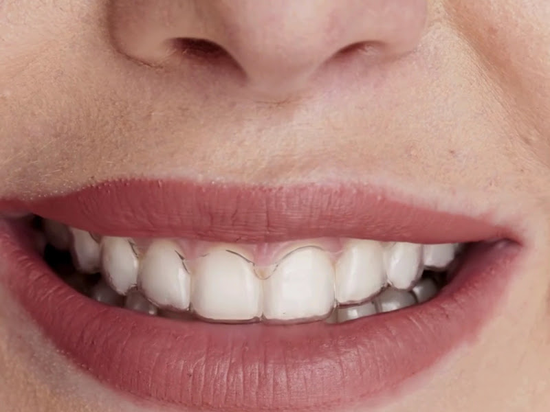 Foto 2 de Barros Odontologia Especializada / Dr. Helio / Dr. Jonas