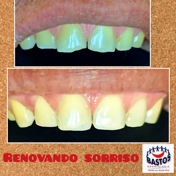 Foto 3 de Bastos Odontologia Santana SP