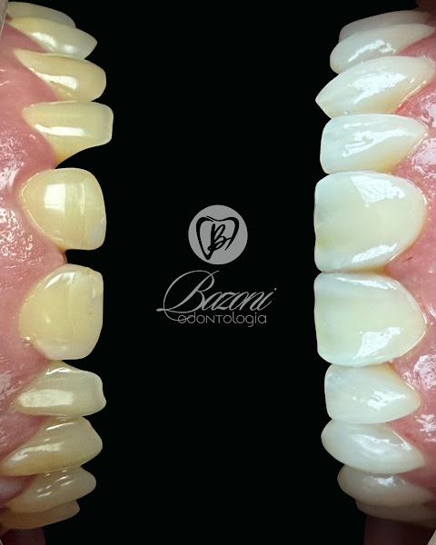 Foto 3 de Bazoni Odontologia | Clínica Odontológica em Cachoeiro de Itapemirim