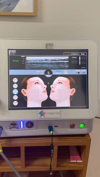 Foto 3 de Be on TOX- Harmonização Facial, Botox, Preenchimento labial, Bioestimulador de colágeno, Sculptra - Araraquara