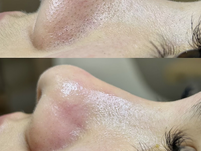 Foto de Beatriz Castilho Esteticista Brasília | Limpeza de pele Lago Norte/DF