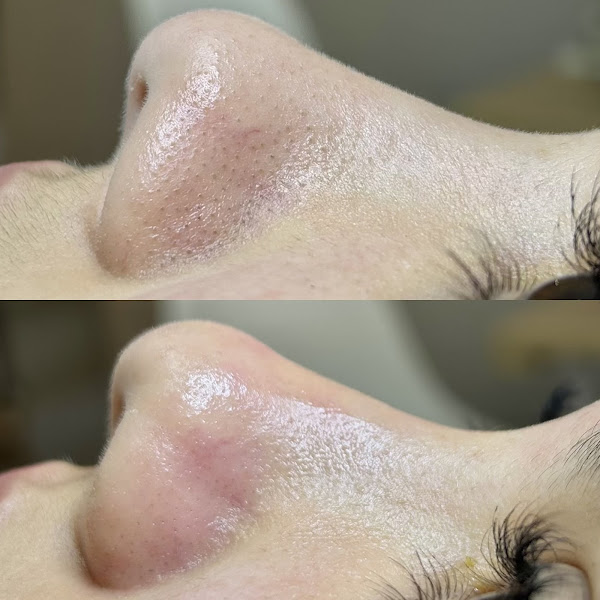 Foto 2 de Beatriz Castilho Esteticista Brasília | Limpeza de pele Lago Norte/DF