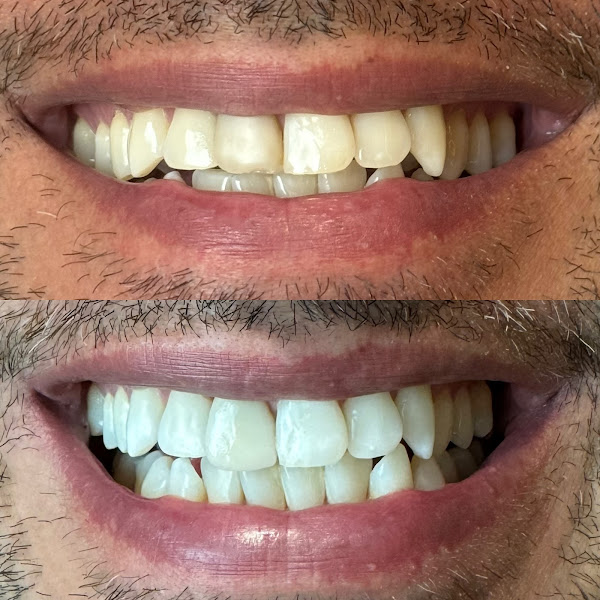 Foto 2 de Beatriz Rievers Odontologia