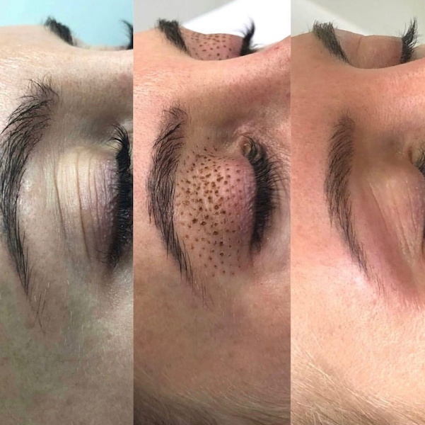 Foto 3 de Beleza Perfeita Estética