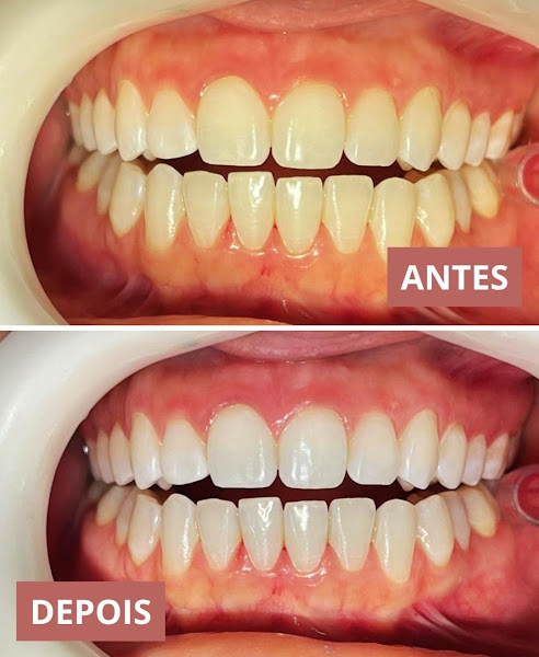 Foto 3 de Beliza Odontologia