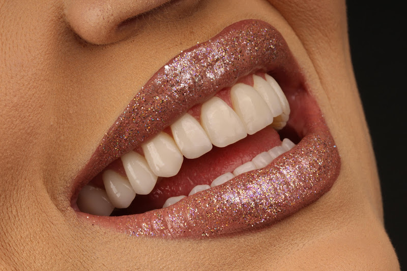 Foto 2 de Bella Cliniche - Lentes de Contato Dental