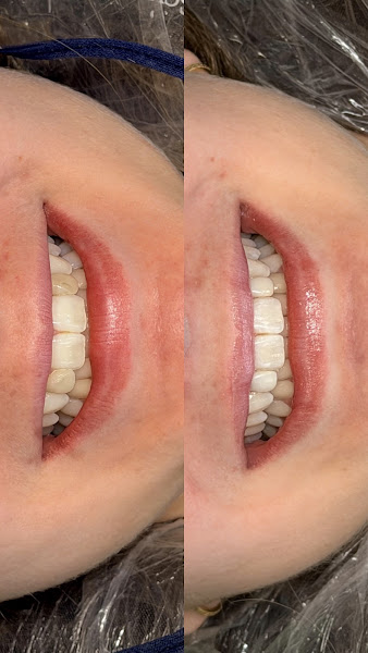 Foto 2 de Bella Face | Odontologia & Estética Orofacial | Ortodontia | Harmonização | Restaurações