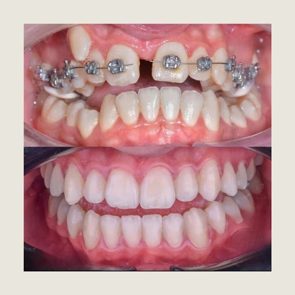 Foto 3 de Bellart Odontologia e Estética - Clínica Odontológica e Implante Dentário em Jundiaí