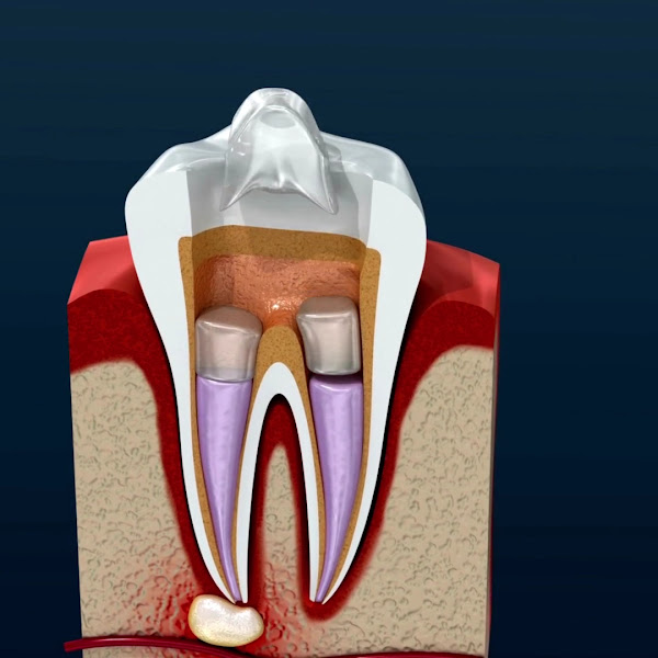 Foto 4 de Bellart Odontologia e Estética - Clínica Odontológica e Implante Dentário em Jundiaí