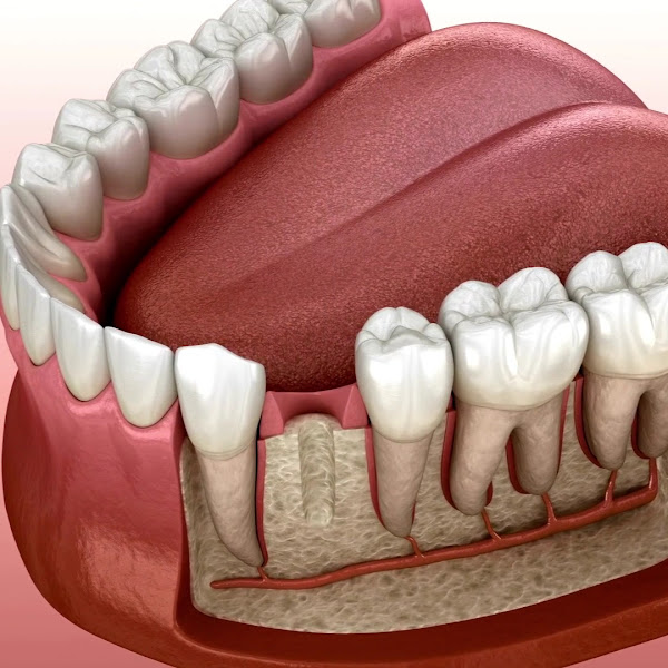 Foto 5 de Bellart Odontologia e Estética - Clínica Odontológica e Implante Dentário em Jundiaí
