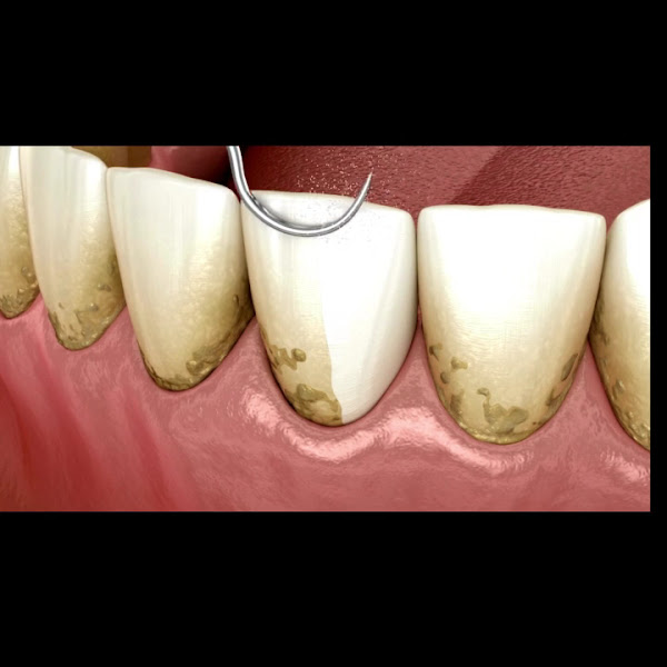 Foto 6 de Bellart Odontologia e Estética - Clínica Odontológica e Implante Dentário em Jundiaí