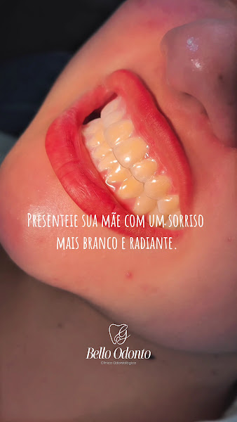 Foto 3 de Bello Odonto Unidade ( Jácira ) em frente ao Batalhão da polícia