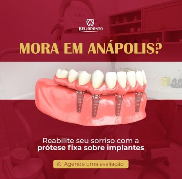 Foto 3 de Bellodonto - Lente de contato dental | Prótese protocolo | Prótese dentária | Implante dentário em Anápolis
