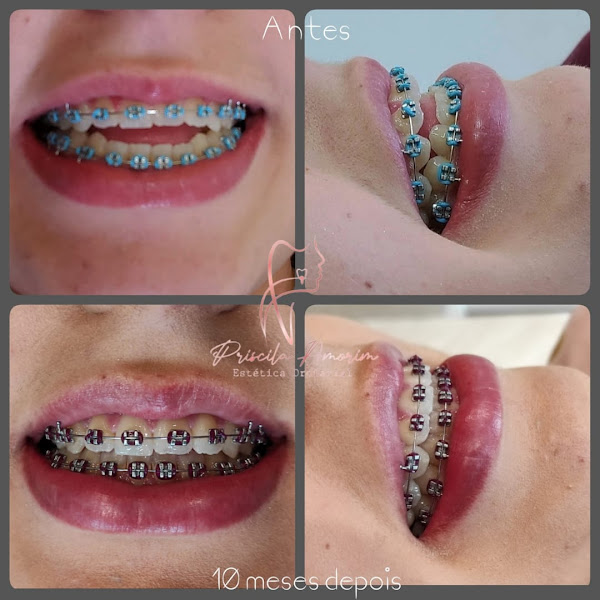 Foto 3 de Bellos Dentes Concept