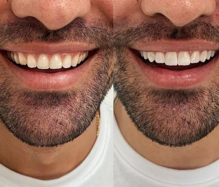 Foto 2 de Belo Dente