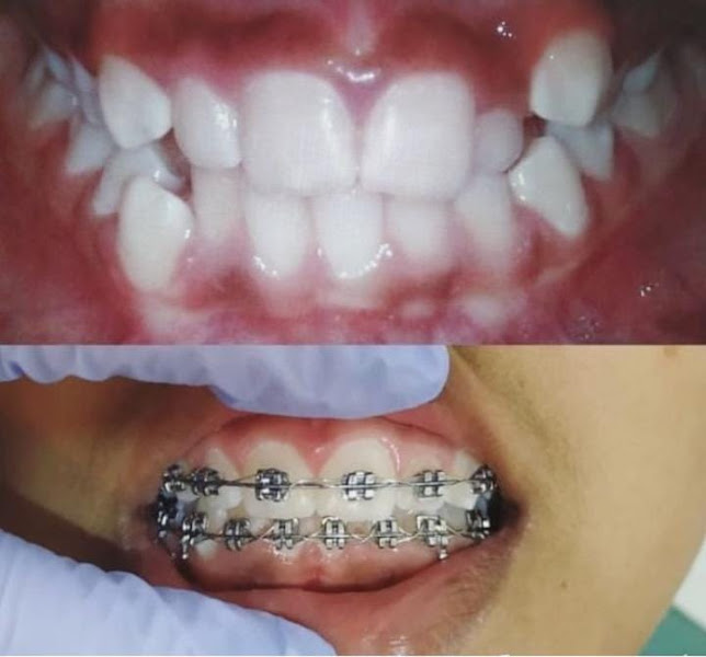 Foto 3 de Belo Dente