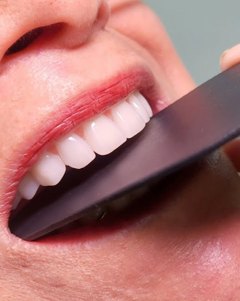 Foto 2 de Belo Sorrir Odontologia I Vieiralves