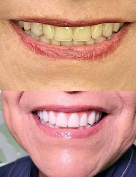 Foto 3 de Belo Sorrir Odontologia I Vieiralves