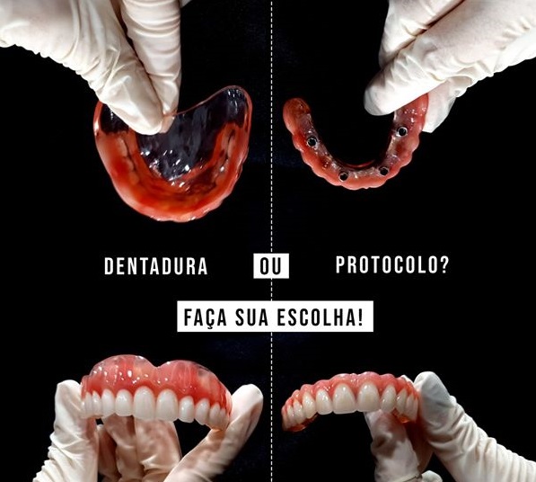 Foto 2 de BeloImplante - Cidade Alta