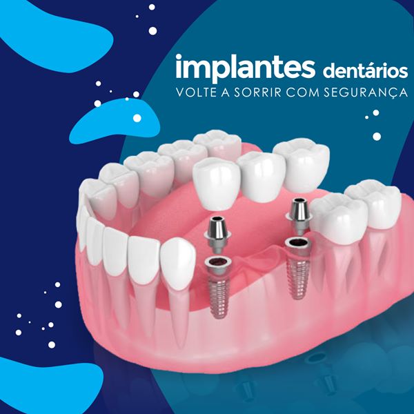 Foto 3 de BeloImplante - Cidade Alta