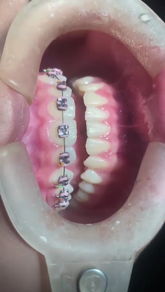 Foto 4 de BeloImplante Mossoró